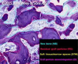 Geistlich Bio-Oss osteointegrazione