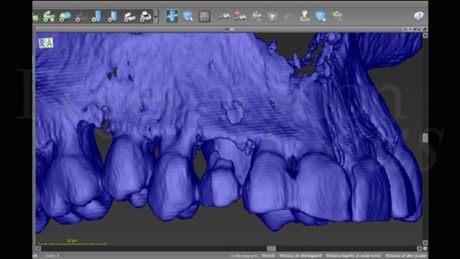 4. Ricostruzione 3D iniziale