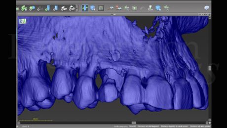 4. Ricostruzione 3D iniziale