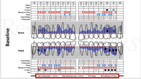 Cartella parodontale alla baseline.