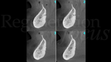 1. Sezioni CBCT